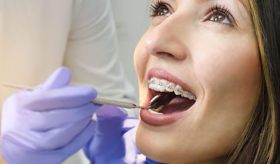 Junge Frau mit Zahnspange beim Zahnarzt